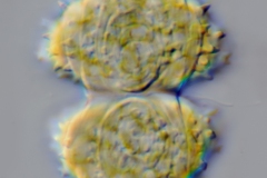 Staurastrum subscabrum