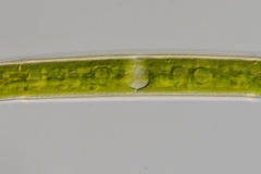 Closterium abruptum
