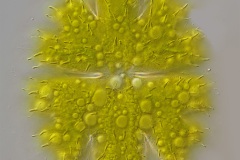 Micrasterias apiculata 2