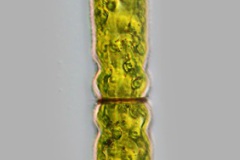 Pleurotaenium trabecula