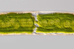 Closterium costatum (2)