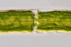 Closterium costatum (1)