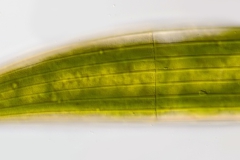 Closterium costatum (3)