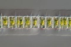 Hyalotheca dissiliens