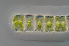 Hyalotheca dissiliens