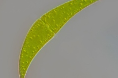 Closterium submoniliferum