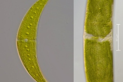Closterium monoliferum und C. striolatum