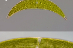 Closterium monoliferum und C. striolatum