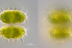 Staurastrum teliferum var. gladiosum