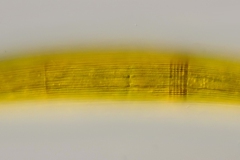Closterium cf. costatum