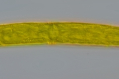 Closterium sp.