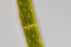 Closterium striolatum 1