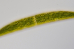Closterium striolatum 1