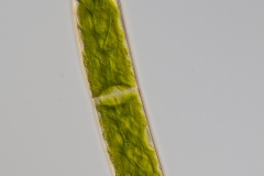 Closterium striolatum 2