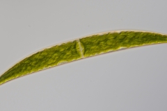 Closterium striolatum 2