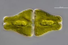 Euastrum ansatum
