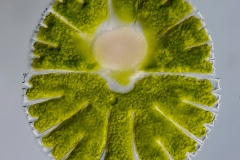Micrasterias mit Parasiten