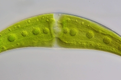 Closterium monoliferum
