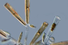 Gomphonema sp.