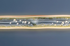 Pinnularia sp.