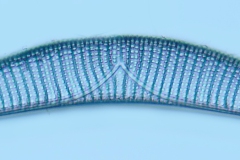 Epithemia turgida