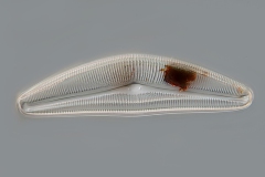 Cymbella sp.