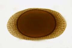 Dauerstadium eines Moostierchens (Flottoblast 186x103 µm)