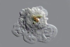 cf. Deuteramoeba algonquinensis