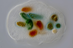 Thecamoeba sp.