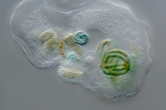 Thecamoeba sphaeronucleolus