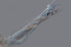 Cothurnia sp.