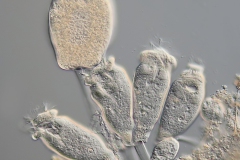 Tokophrya quadripartitia und Opercularia articulata