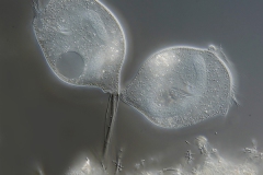 Vorticella cf. infusorium Komplex