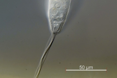 Vorticella cf.-octava Komplex