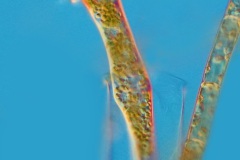 Vaginicola sp.