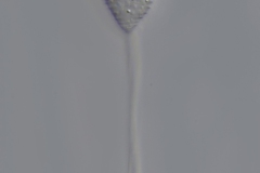 Vorticella aquadulcis
