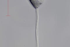 Vorticella aquadulcis