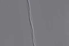 Vorticella convallaria