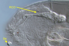 Dicranophorus sp. (3) Dicranophorus sp. (3)