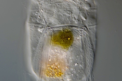 Polyarthra sp.
