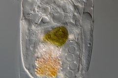 Polyarthra sp.
