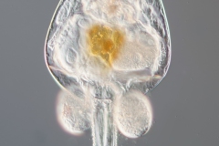 Brachionus sp..