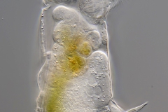 Cephalodella cf. catellina