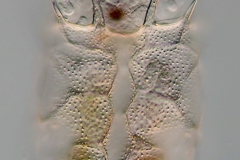 Keratella ticinensis