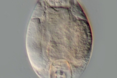 Lepadella sp.