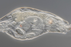 Rotaria sp. (2) Rotaria sp. (2)