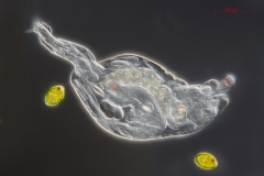 Rotaria sp. (1) Rotaria sp. (1)
