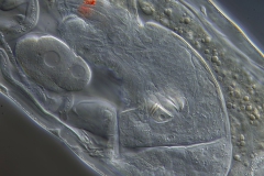 Rotaria sp. (3) Rotaria sp. (3)