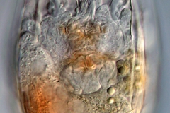 Keratella sp.