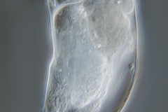 Cephalodella cf. auriculata Cephalodella cf. auriculata